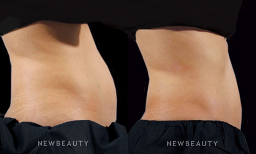 Body Treatments Case 1