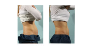 Skinfluence Body Treatments