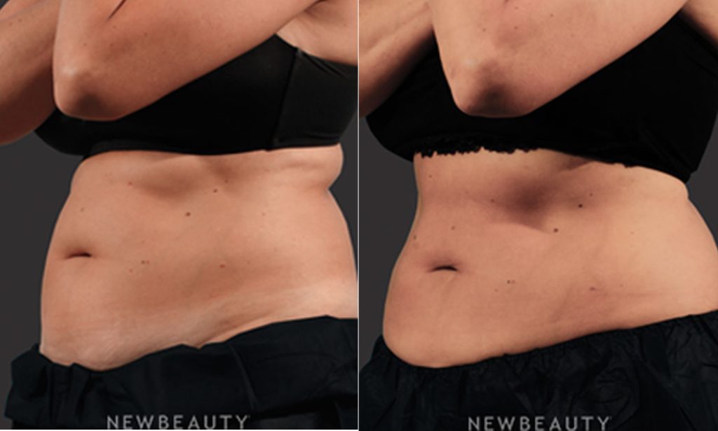 Body Treatments Case 2